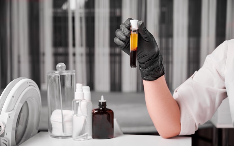 Kreatinin testi nedir?