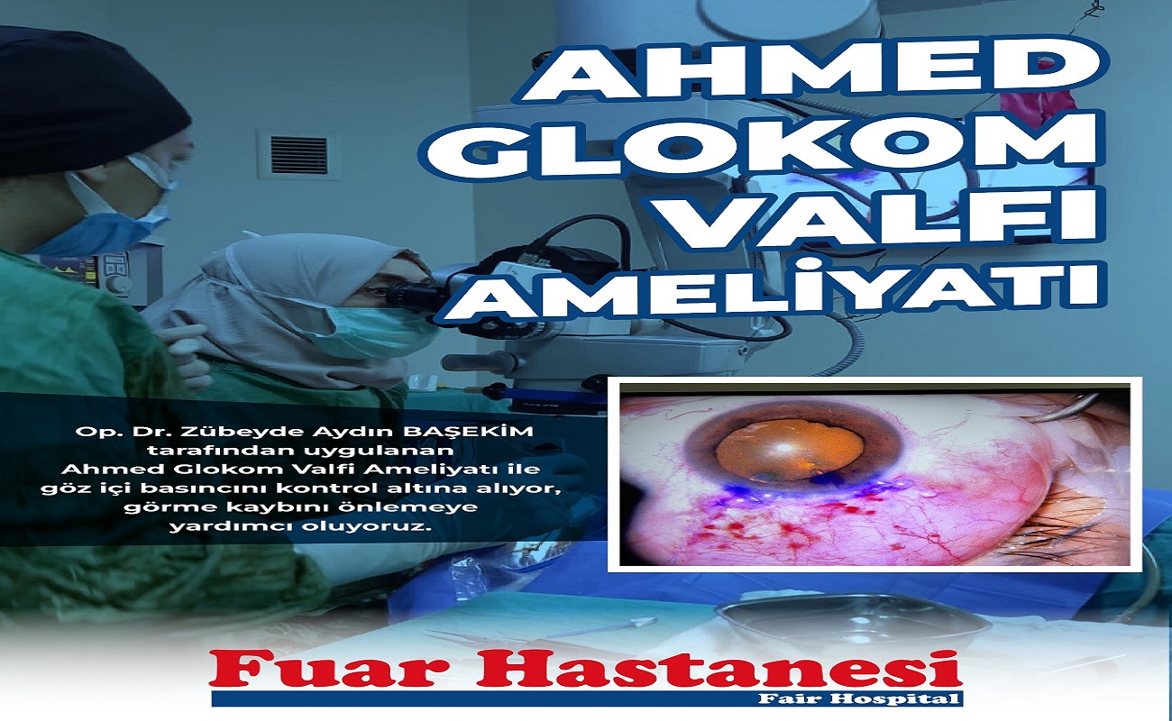 Göz Tansiyonunda (Glokom) Ameliyatla Başarı