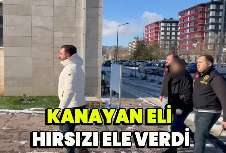 Kanayan eli hırsızı ele verdi