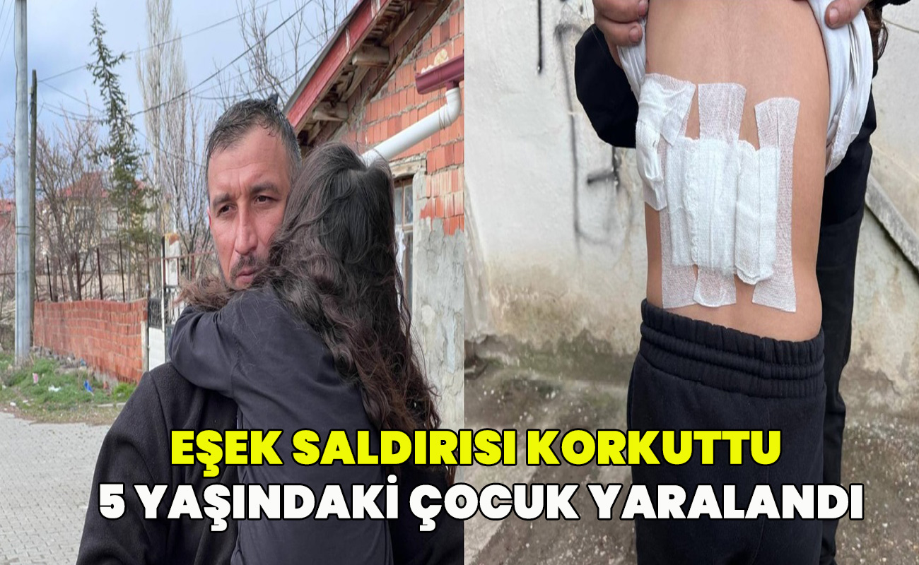 Eşek saldırısı korkuttu: 5 yaşındaki çocuk yaralandı